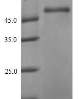 Staphylococcus aureus Gamma-hemolysin component B (hlgB) Recombinant Protein - BioCrest Sci