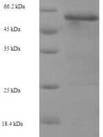 Bovine Keratin, type I cytoskeletal 17 (KRT17) Recombinant Protein - BioCrest Sci