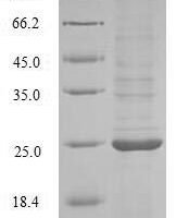 Avena sativa Endochitinase, partial Recombinant Protein, N-10His/C-Myc - BioCrest Sci