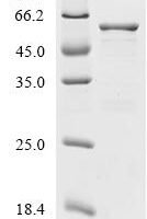 Human Peripherin (PRPH) Recombinant Protein, Tag-Free - BioCrest Sci