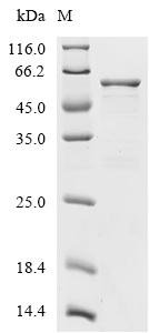 Human Peripherin (PRPH) Recombinant Protein, Tag-Free, Homo sapiens (Human), E.coli, Tag-Free, 53.8 kDa, purity >≥ 85% as determined by SDS-PAGE.