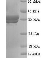 Cynops pyrrhogaster Annexin A5 Recombinant Protein, N-His, aa 1–323, Yeast - BioCrest Sci