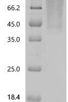 Human Interleukin-10 receptor subunit alpha (IL10RA)(R117H), partial Recombinant Protein - BioCrest Sci
