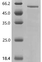 Mouse Sarcoplasmic/endoplasmic reticulum calcium ATPase 3 (Atp2a3), partial Recombinant Protein - BioCrest Sci