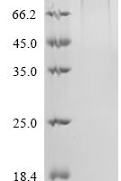 Human Epidermal growth factor receptor (EGFR), partial,Biotinylated Recombinant Protein - BioCrest Sci