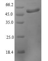 Human MICOS complex subunit MIC19 (CHCHD3) Recombinant Protein - BioCrest Sci