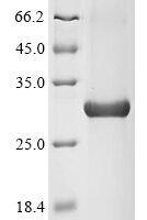 Human Aryl hydrocarbon receptor (AHR), partial Recombinant Protein - BioCrest Sci