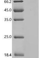 Human V-type proton ATPase subunit C 1 (ATP6V1C1) Recombinant Protein, C-hFc1 - BioCrest Sci