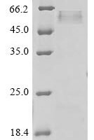 Human Dystroglycan (DAG1), partial Recombinant Protein, N-His - BioCrest Sci