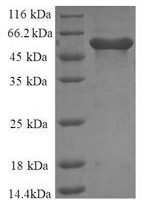 Human Annexin A6 (ANXA6), partial Recombinant Protein - BioCrest Sci