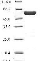 Human Hydroxymethylglutaryl-CoA lyase, mitochondrial (HMGCL) Recombinant Protein - BioCrest Sci