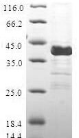 Human Calcitonin gene-related peptide 2 (CALCB) Recombinant Protein - BioCrest Sci
