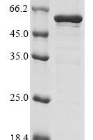 Human Chromobox protein homolog 8 (CBX8) Recombinant Protein, N-10His/C-Myc - BioCrest Sci