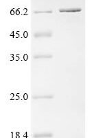 Escherichia coli Alpha,alpha-phosphotrehalase Recombinant Protein - BioCrest Sci