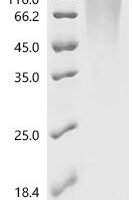 Human Vascular endothelial zinc finger 1 (VEZF1) Recombinant Protein, C-His, aa 1–521, Yeast - BioCrest Sci