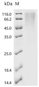 Human Vascular endothelial zinc finger 1 (VEZF1) Recombinant Protein, C-His, aa 1–521, Yeast, Homo sapiens (Human), Yeast, C-terminal 6xHis-tagged, 58.2 kDa, purity >≥ 95% as determined by SDS-PAGE.