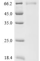 Human Tumor necrosis factor receptor superfamily member 6B (TNFRSF6B) Recombinant Protein, C-hFc1 - BioCrest Sci