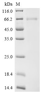 Human Tumor necrosis factor receptor superfamily member 6B (TNFRSF6B) Recombinant Protein, C-hFc1, Homo sapiens (Human), Mammalian cell, C-terminal hFc1-tagged, 57.2 kDa, purity >≥ 95% as determined by SDS-PAGE.