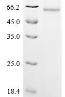 Human Formimidoyltransferase-cyclodeaminase (FTCD) Recombinant Protein, C-His, aa 1–541, Baculovirus - BioCrest Sci