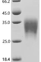 Human Activin receptor type-2A (ACVR2A), partial, Biotinylated Recombinant Protein - BioCrest Sci