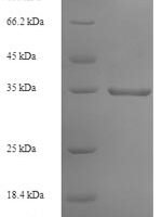 Human Ephrin-A1 (EFNA1) Recombinant Protein - BioCrest Sci