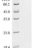 Human LIM domain kinase 2 (LIMK2), partial Recombinant Protein - BioCrest Sci