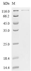 Human LIM domain kinase 2 (LIMK2), partial Recombinant Protein, Homo sapiens (Human), Mammalian cell, N-terminal HSA-tagged and C-terminal 10xHis-tagged, 103.7 kDa, purity >≥ 95% as determined by SDS-PAGE.