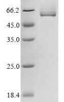 Rat Intestinal-type alkaline phosphatase 1 (Alpi) Recombinant Protein - BioCrest Sci