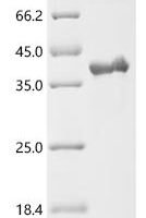 Spinacia oleracea Phosphoribulokinase, chloroplastic Recombinant Protein, C-His, aa 52–402, Yeast - BioCrest Sci