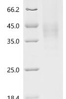 Mouse Macrophage colony-stimulating factor 1 (Csf1), partial Recombinant Protein, C-10His - BioCrest Sci