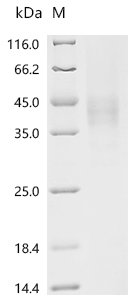 Mouse Macrophage colony-stimulating factor 1 (Csf1), partial Recombinant Protein, C-10His, Mus musculus (Mouse), Yeast, C-terminal 10xHis-tagged, 28.0 kDa, purity >≥ 95% as determined by SDS-PAGE.
