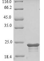 Mouse Cell surface hyaluronidase (Tmem2), partial Recombinant Protein, N-10His, aa 104–250, E.coli - BioCrest Sci