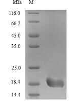 Alternaria alternata Heat shock 70 kDa protein (HSP70), partial Recombinant Protein, N-His, aa 1–152, Yeast - BioCrest Sci