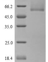 Human Cartilage intermediate layer protein 1 (CILP), partial Recombinant Protein, N-His - BioCrest Sci