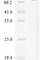 Wolinella succinogenes Fumarate reductase flavoprotein subunit (frdA) Recombinant Protein - BioCrest Sci
