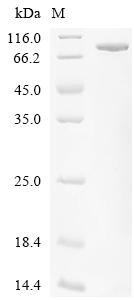 Wolinella succinogenes Fumarate reductase flavoprotein subunit (frdA) Recombinant Protein, Wolinella succinogenes (strain ATCC 29543 / DSM 1740 / CCUG 13145 / JCM 31913 / LMG 7466 / NCTC 11488 / FDC 602W) (Vibrio succinogenes), E.coli, C-terminal 6xHis-tagged, 79.6 kDa, purity >≥ 90% as determined by SDS-PAGE.