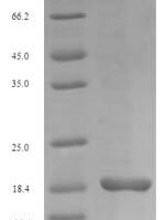 Euroglyphus maynei Mite group 2 allergen Eur m 2 (EURM2) Recombinant Protein, N-His - BioCrest Sci