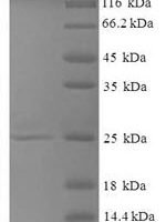 Mouse Thioredoxin reductase-like selenoprotein T (Selenot) Recombinant Protein - BioCrest Sci