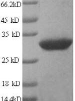 Human GPI-linked NAD (P) (+)--arginine ADP-ribosyltransferase 1 (ART1) Recombinant Protein - BioCrest Sci