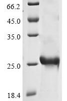 Avian infectious bronchitis virus Spike glycoprotein (S), partial Recombinant Protein, C-His, aa 300–520, strain UK/123/82 - BioCrest Sci