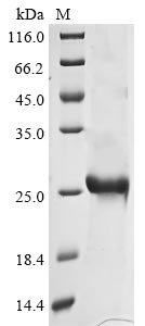 Avian infectious bronchitis virus Spike glycoprotein (S), partial Recombinant Protein, C-His, aa 300–520, strain UK/123/82, Avian infectious bronchitis virus (strain UK/123/82) (IBV), E.coli, C-terminal 6xHis-tagged, 25.7 kDa, purity >≥ 85% as determined by SDS-PAGE.