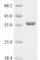 Shigella flexneri Nucleoside-specific channel-forming protein tsx (tsx) Recombinant Protein - BioCrest Sci