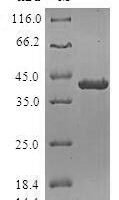 Human DNA-directed RNA polymerases I and III subunit RPAC2 (POLR1D) Recombinant Protein - BioCrest Sci