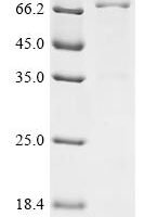 Human Myeloblastin (PRTN3),Biotinylated Recombinant Protein - BioCrest Sci