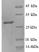 Human Trypsin-3 (PRSS3), partial Recombinant Protein - BioCrest Sci