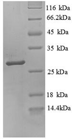 Human Trypsin-3 (PRSS3), partial Recombinant Protein, Homo sapiens (Human), E.coli, N-terminal 6xHis-tagged, 28.2 kDa, purity >≥ 90% as determined by SDS-PAGE.