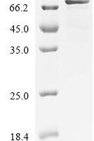 Human Tyrosine-protein kinase SYK (SYK) Recombinant Protein - BioCrest Sci