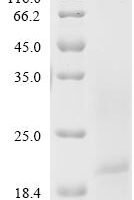 Human Ly6/PLAUR domain-containing protein 1 (LYPD1) Recombinant Protein, C-His, aa 21–117, Yeast - BioCrest Sci