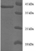 Human Alpha-endosulfine (ENSA) Recombinant Protein - BioCrest Sci
