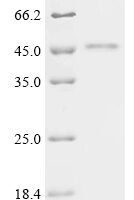 Tick-borne encephalitis virus European subtype Genome polyprotein, partial Recombinant Protein, C-His - BioCrest Sci